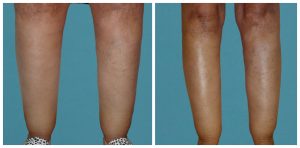jambes 300x148